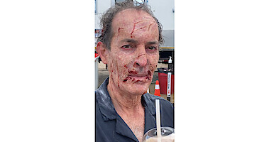 A Day in the Life of a Zero From 'Resident Evil'