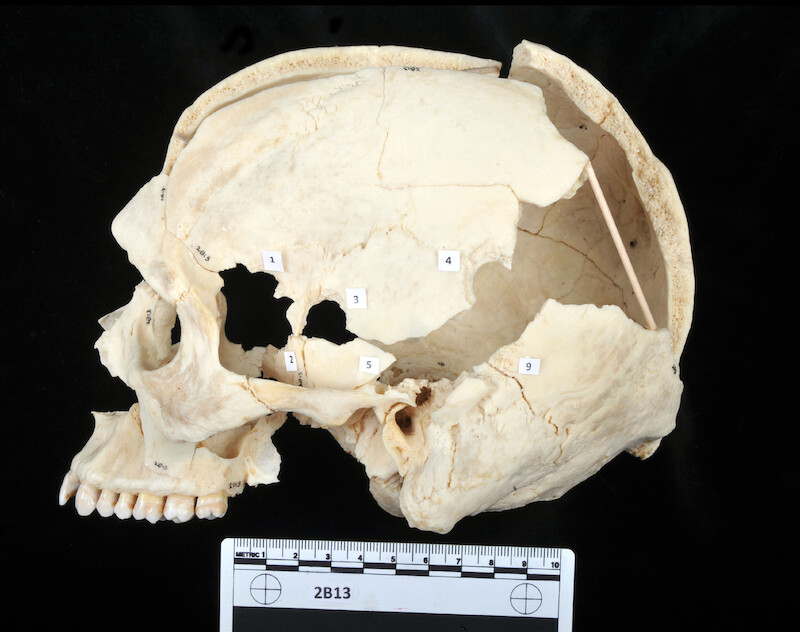 Reconstructed skull