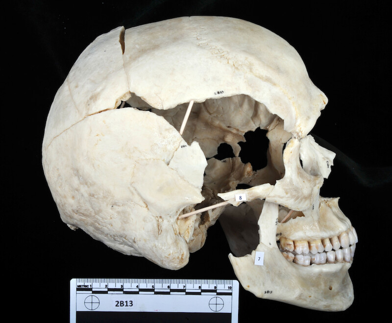 Reconstructed Skull
